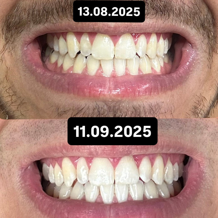 Miswak 4 Monatsvorrat  (6Stk)